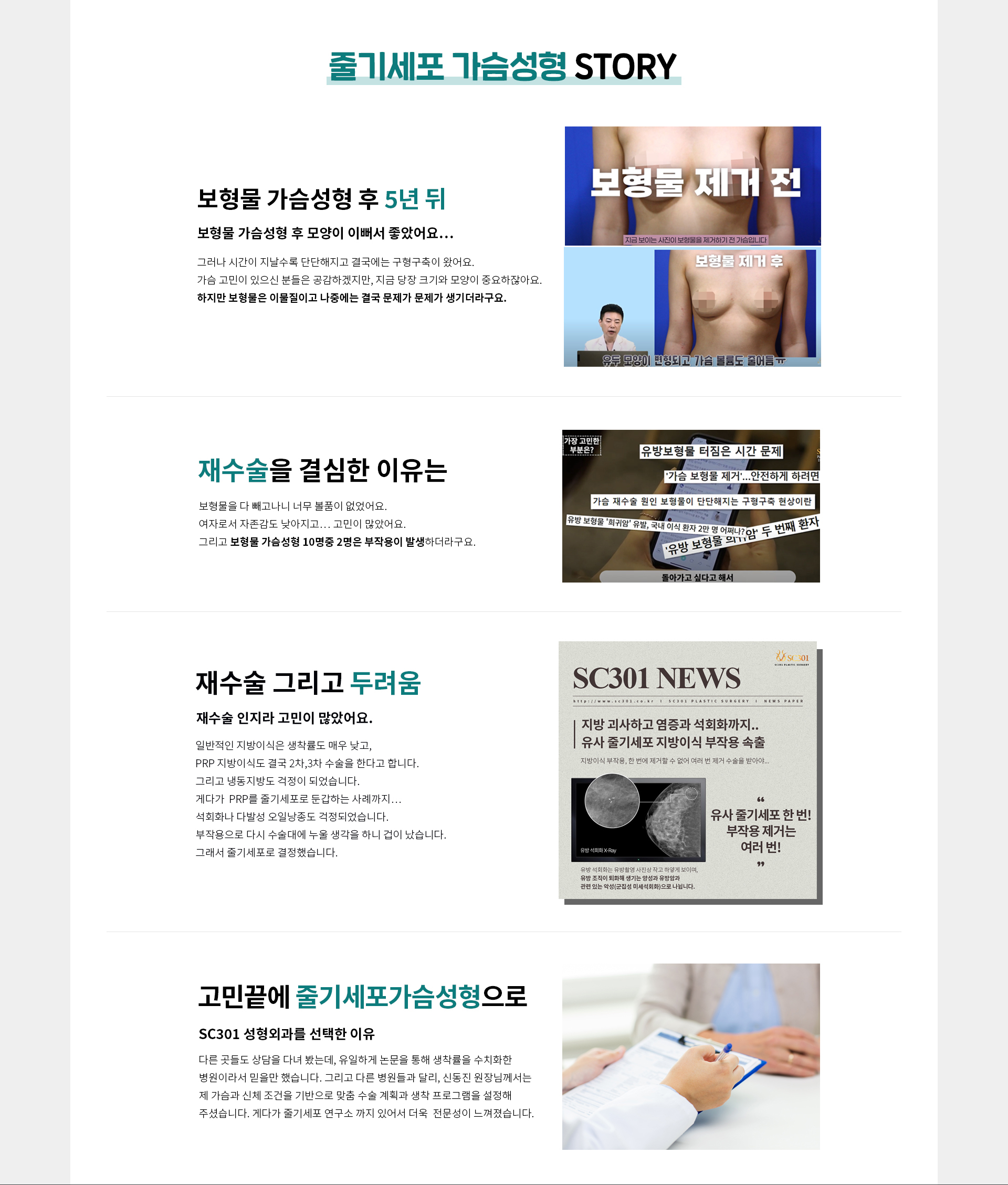 줄기세포 가슴성형 스토리